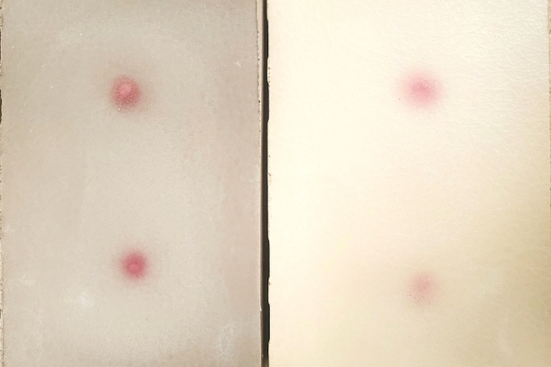 Sim*Abscess